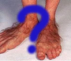 Real Hobbits Weigh In on New Trends for the Hair “Down There” (On Their&nbsp;Feet)